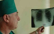 Показник захворюваності на туберкульоз у Харківскій області – один найнижчих в Україні