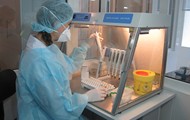 В обласному протитуберкульозному диспансері №1 відкрито лабораторію для молекулярно-генетичної діагностики туберкульозу